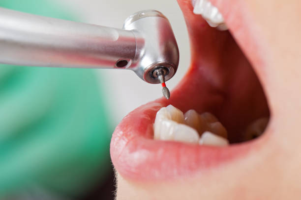 Best Dentist for Tooth Abscess  in Pottsville, AR